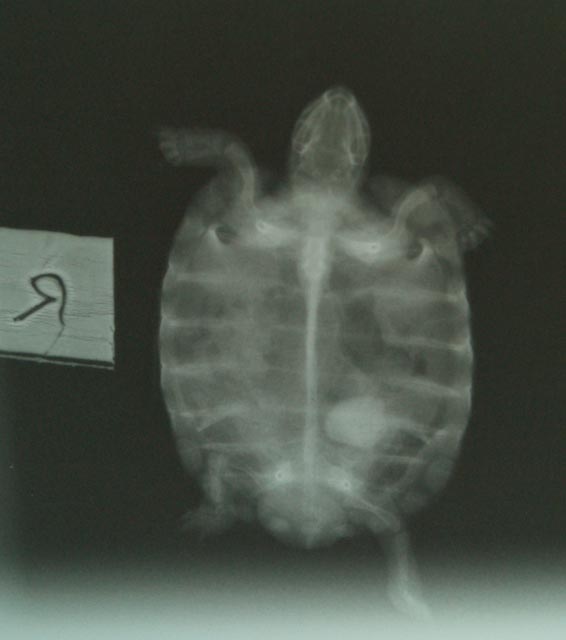 Medium bladder stone